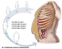 糖耐量異常