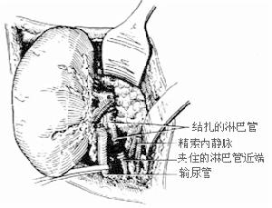 （圖）診斷