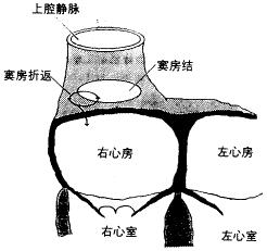 心房內折返性心動過速