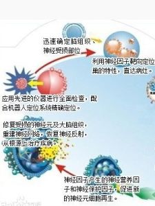 神經組織修復療法