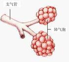 流感嗜血桿菌肺炎