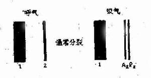 第二心音分裂示意圖