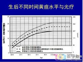 黃疸指數