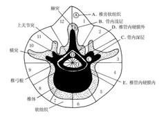 脊柱腫瘤