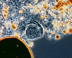 油螺旋菌屬