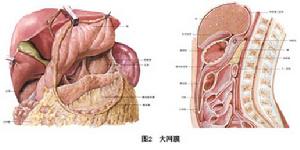 小網膜囊疝 圖2