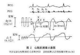 心阻抗血流圖