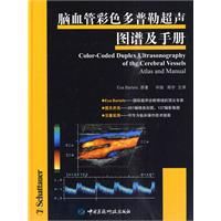 腦血管彩色都卜勒超聲圖譜及手冊
