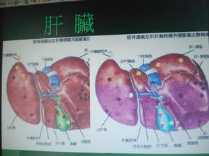 多器官功能障礙綜合症