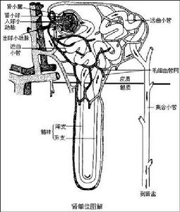 高鈣血症腎病