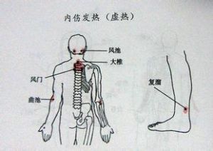 虛熱