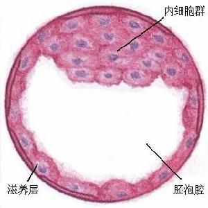 結核性陰道炎