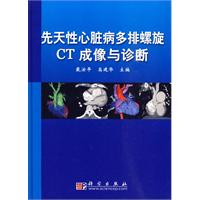 先天性心臟病多排螺旋CT成像與診斷