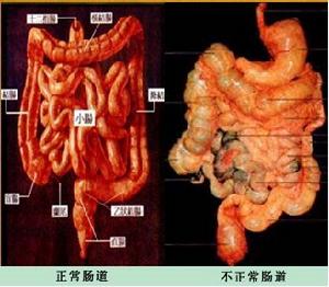 俄式人體清毒