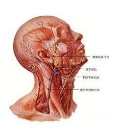 腹膜後淋巴結炎