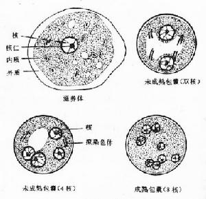 阿米巴病