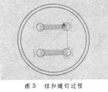 釘紐扣縫紉機