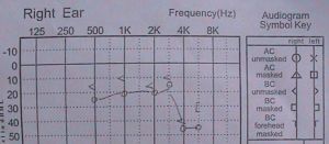 純音聽閾測試