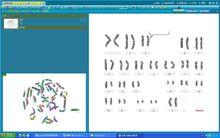 染色體圖像分析系統