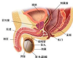 慢性附睪炎