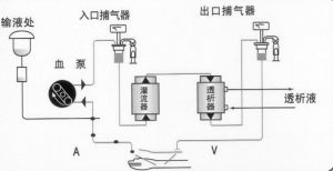 血液透析串聯血液灌流