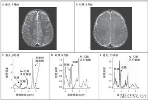 非致死性急性毒性