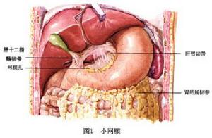 小網膜囊疝 圖1