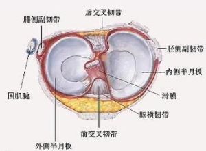 膝蓋半月板損傷