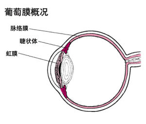 伴葡萄膜炎綜合症