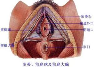 前庭大腺囊腫