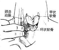 腰椎椎管狹窄症