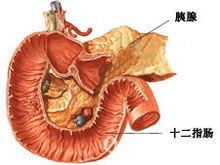 胰腺膿腫