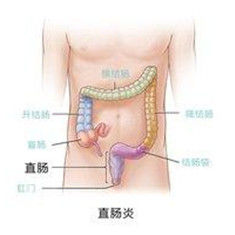 理氣舒腸方