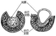 示意圖7:肌層切開後管腔擴大的樣子