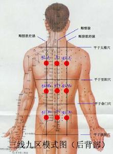 調理後背部三線九區模式圖