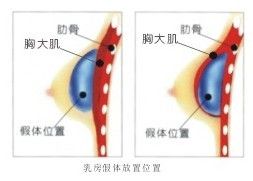 原理示意圖