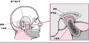 顳下頜關節功能紊亂綜合症