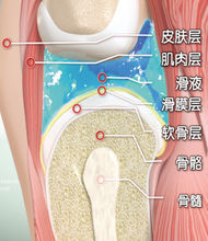 風濕骨痛