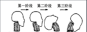 揮鞭傷