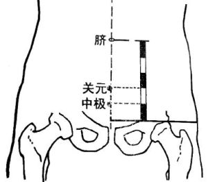 中極穴