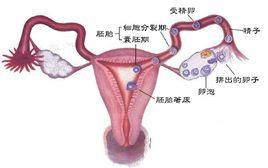 雙側多囊卵巢