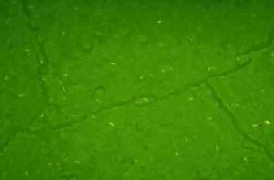 採用金胺染色法分支桿菌肺結核螢光顯微鏡圖像