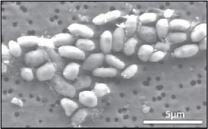 以劇毒砷生長的菌株GFAJ-1,將改寫生物教科書，使地球外尋找生命的範圍得以拓展