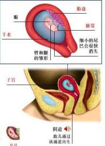 新生兒肛門和直腸畸形