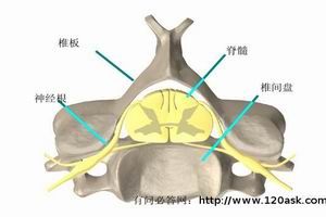 胸內甲狀腺腫