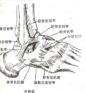踝部急性韌帶損傷
