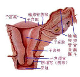 子宮癌