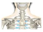 頸肋綜合徵