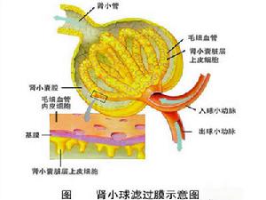 急性鏈球菌感染後腎小球腎炎