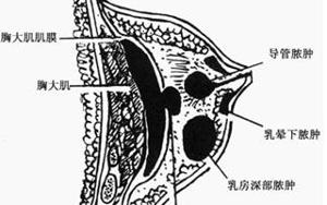 急性乳房炎